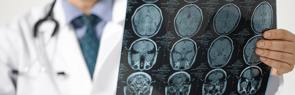 Neorologista Neurologista em Uberlândia | Agende sua consulta no UMC • UMC